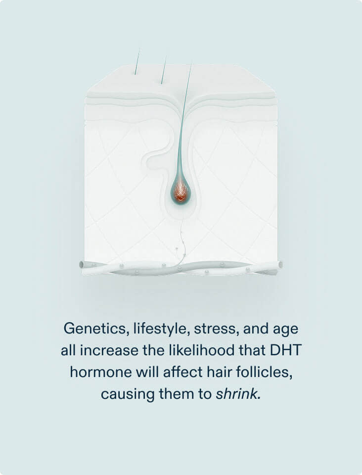 Nutrafol DHT Inhibitor MD (1 month)