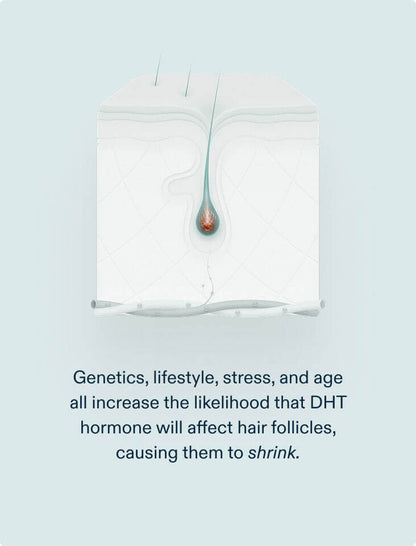 Nutrafol DHT Inhibitor MD (1 month)